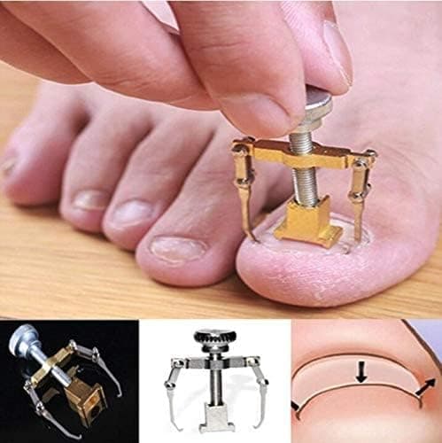 Ingrown Toenail Toe Fixer Recover Correction Device Protector Tool Pedicure Care