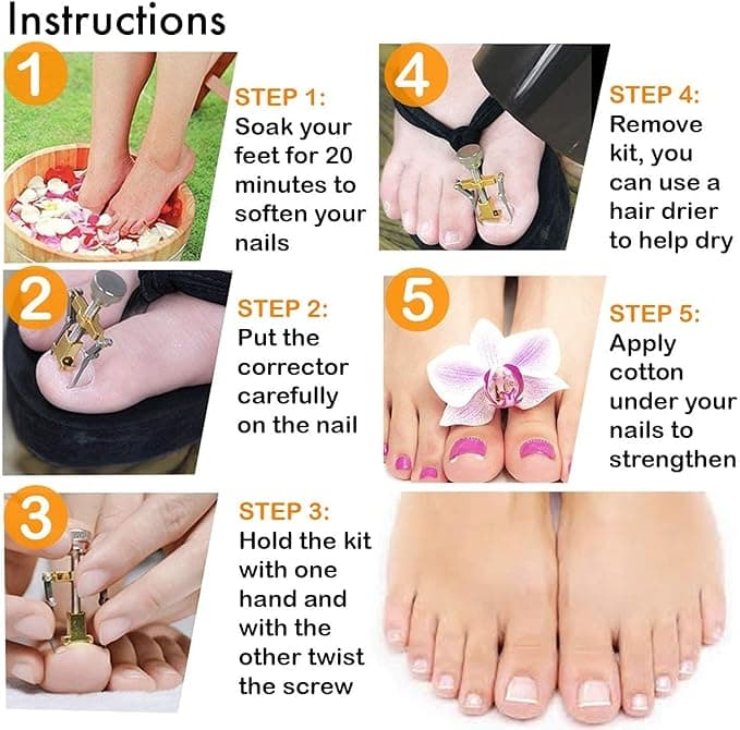 Ingrown Toenail Toe Fixer Recover Correction Device Protector Tool Pedicure Care