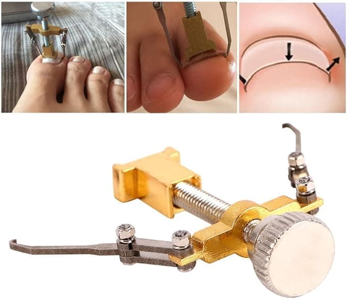 Ingrown Toenail Toe Fixer Recover Correction Device Protector Tool Pedicure Care