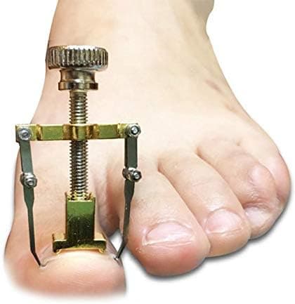 SOLLER Ingrown Toenail Correction Toe Clamp Stainless Steel Health Tool