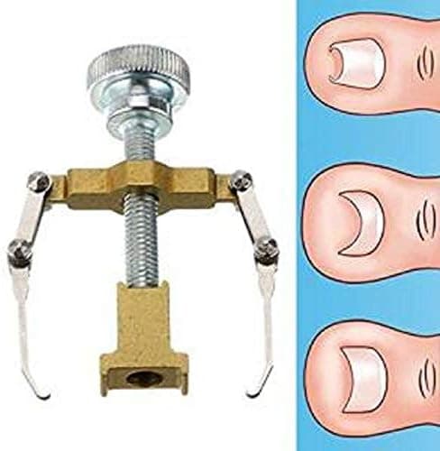 SOLLER Ingrown Toenail Correction Toe Clamp Stainless Steel Health Tool