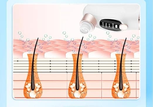 LIWEARE Blackhead Suction Pore Cleaner, 6 Suction Heads, 3 Modes, USB Charging F