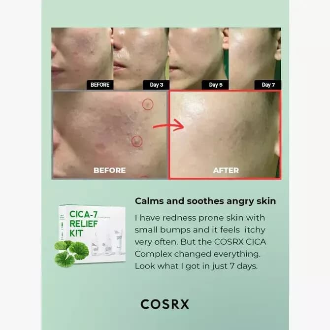 Cosrx Cica-7 Relief Kit For Sensitive Skin