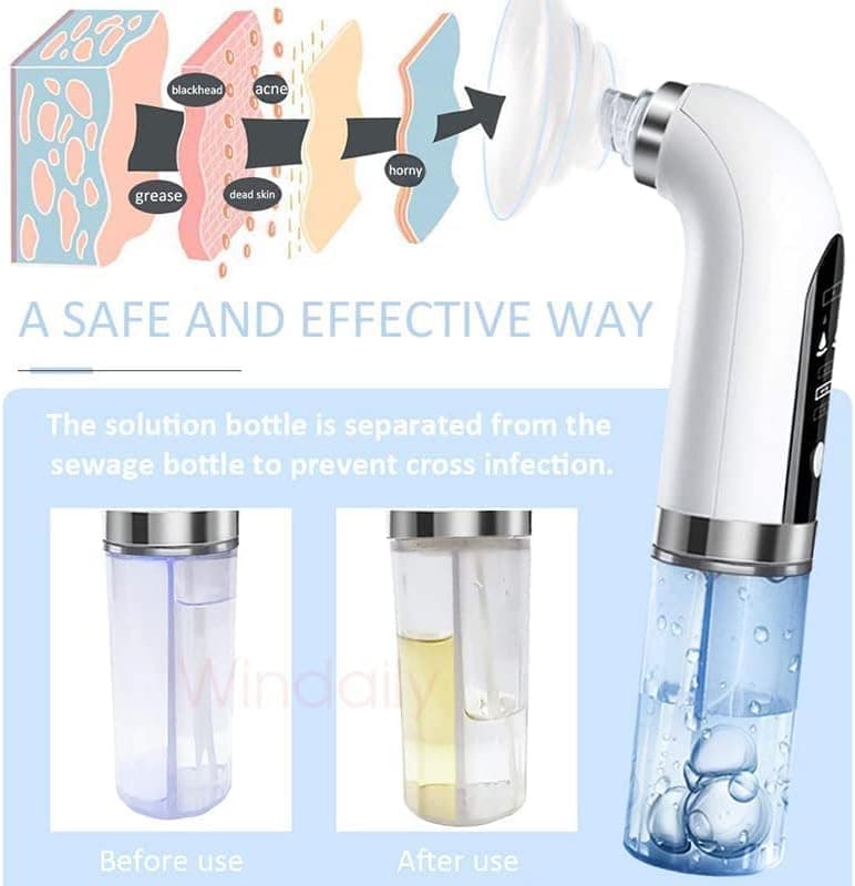 ZHENGJC Blackhead Remover Skin Scrubber Facial Cleaner Skin Peeling Face Scrubbe