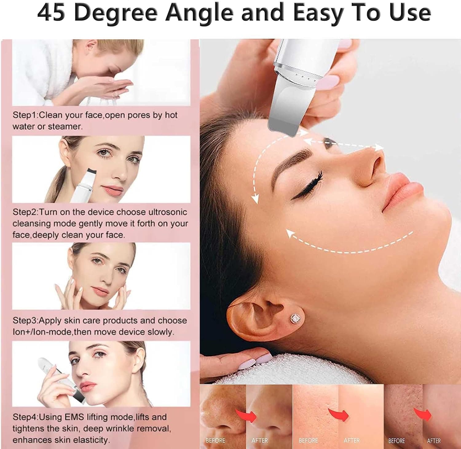 XinBarber Facial Skin Scrubber, Ultrasonic EMS Exfoliating Device Blackhead Remo