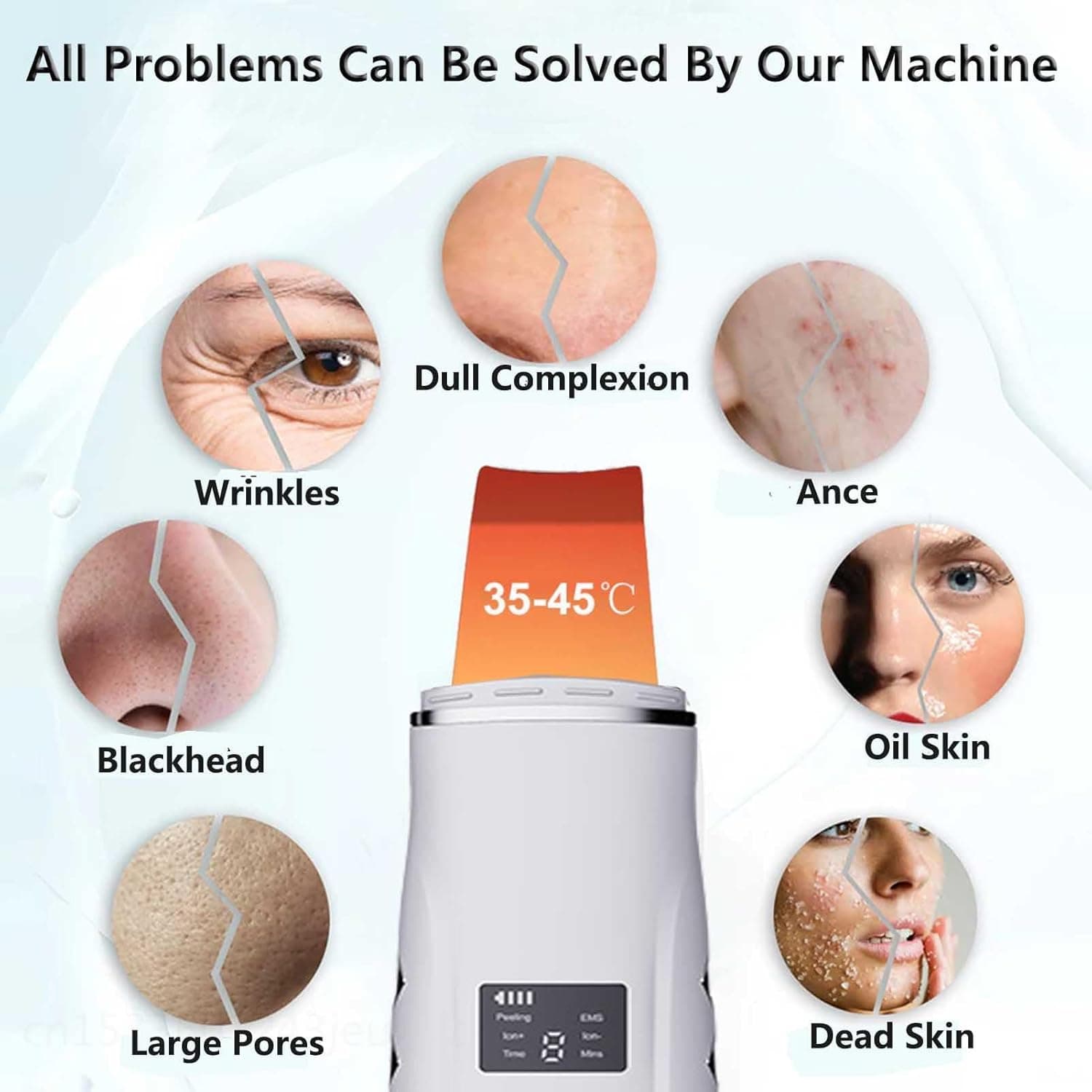 XinBarber Facial Skin Scrubber, Ultrasonic EMS Exfoliating Device Blackhead Remo