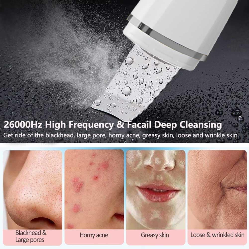 XinBarber Facial Skin Scrubber, Ultrasonic EMS Exfoliating Device Blackhead Remo